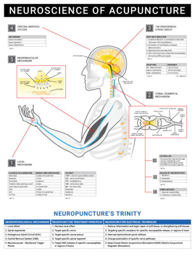 Wall Chart - Neuroscience of Acupuncture