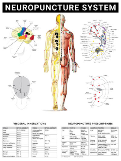 Wall Chart - Neuropuncture System