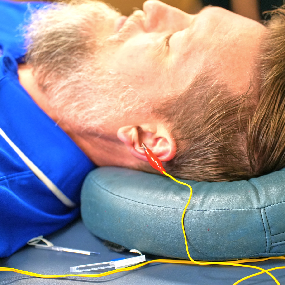 Dr. Michael Corradino teaching a Neuropuncture neuroscience acupuncture workshop